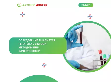 Определение РНК вируса гепатита С в крови методом ПЦР, качественный